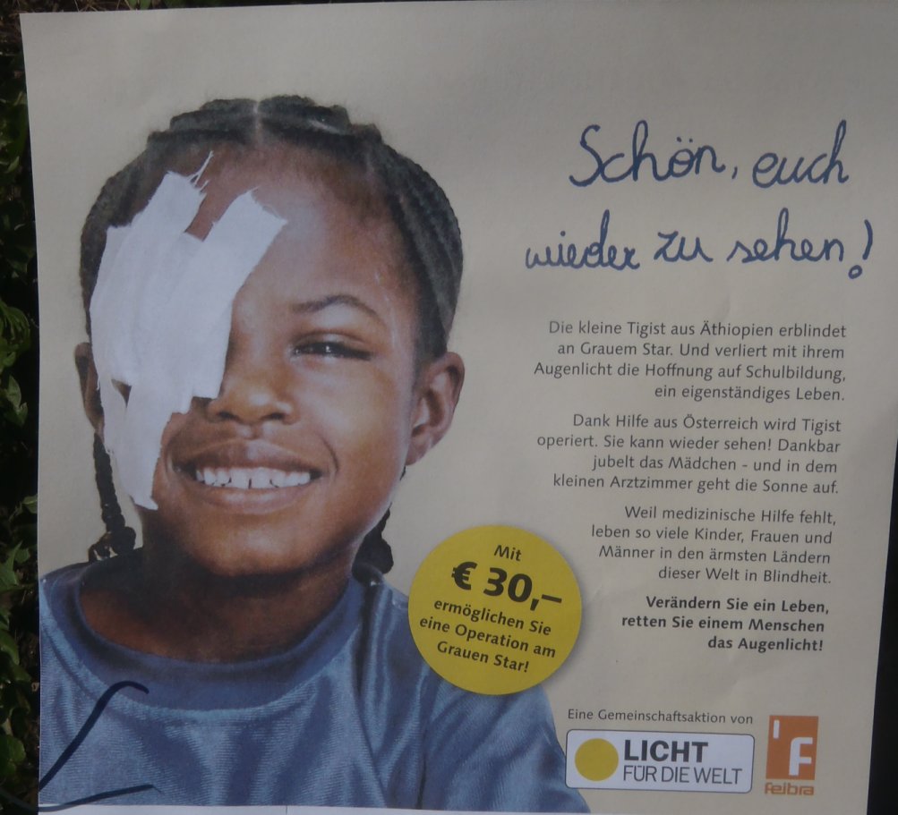 Mit dreissig Euro kann in Afrika eine Operation am Grauen Star durchgeführt werden - in einem europäischen Krankenhaus kostet dies mehr als das tausendfache